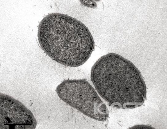 초고온성 고세균류 현미경 사진 의 사진