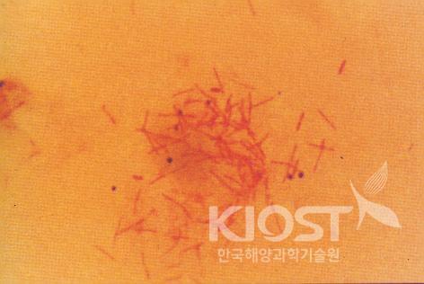 2장-9 이미지 (배지상에서 담황색의 집락을 형성하는 장간균) 의 사진