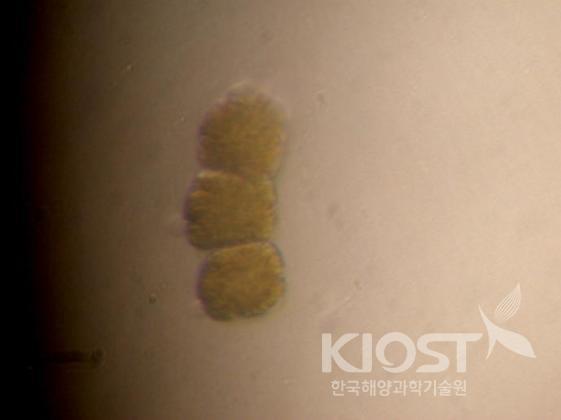 하헬라 제주엔시스의 색소에 의해 적조생물 코크로디니움의 세포가 터저 죽어가는 모습 의 사진