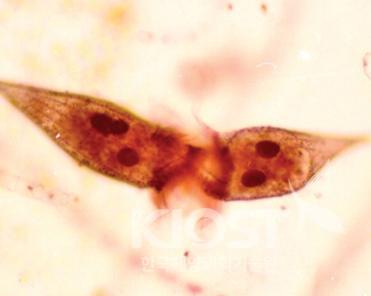 미소생물 먹이망의 주요생물 구성원 : QPS로 염색된 부유성 성모충 의 사진