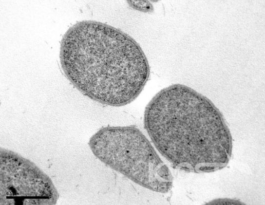 열수구 유래 초고온성 미생물의 전자현미경 사진 의 사진